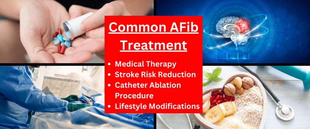 common afib treatment includes medication, procedures, and lifestyle modifications