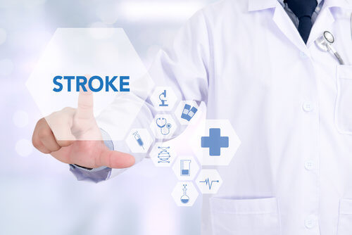 AFib and Stroke: Understanding the Connection and Symptoms