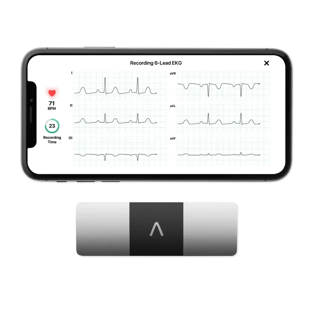 Kardiamobile 6L: революция в мониторинге здоровья сердца
